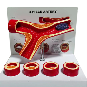 Medical Science Anatomy Artery Blood Vessel Medicine Pathology Thrombus teaching Model - Product Image 4
