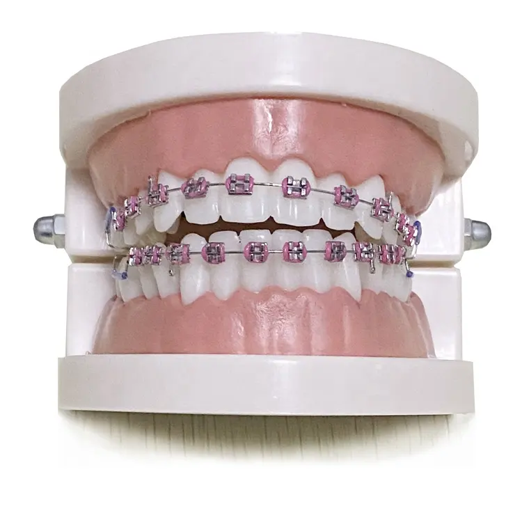 Vendita calda prodotti dentali usa attrezzature di bellezza odontologia staffe ortodoncia alla moda bretelle finte per denti