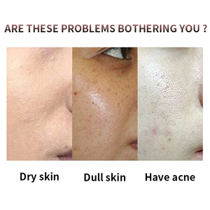 <span class=keywords><strong>2025</strong></span> Hữu Cơ Kem Dưỡng Ẩm Vẻ Đẹp Sản Phẩm Dễ Dàng Để Có Khuôn Mặt Chăm Sóc Da Kit Mặt Tăng Du Lịch Chăm Sóc Da Bộ - Product Image 4