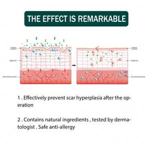 แผ่นซิ<span class=keywords><strong>ล</strong></span>ิโคนดูแลผิว แผ่นซิ<span class=keywords><strong>ล</strong></span>ิโคน<span class=keywords><strong>ล</strong></span>ดรอยแผ<span class=keywords><strong>ล</strong></span>เป็น แผ่นซิ<span class=keywords><strong>ล</strong></span>ิโคนใส แผ่นแปะลดรอยแผ<span class=keywords><strong>ล</strong></span>เป็น เจ<span class=keywords><strong>ล</strong></span>ซ่อมแซมแผลไฟไหม้ แผ่นซิ<span class=keywords><strong>ล</strong></span>ิโคนนุ่มสำหรับศั<span class=keywords><strong>ล</strong></span>ยกรรม แผ่นแปะติดเอง - Product Image 3