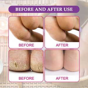 เกลืออาบน้ำขัดผิวขัดเท้าแบบใช้แล้วทิ้งผลิตภัณฑ์ดูแลผิวทำจากคริสตัลสำหรับสปาเท้าแช่เท้า - Product Image 5