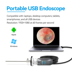 Medical Endoscope USB2.0/USB3.0 4K Camera with HDMI/SDI Output - Product Image 2