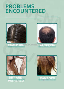 OTVENA <span class=keywords><strong>Meilleur</strong></span> <span class=keywords><strong>sérum</strong></span> en spray pour la croissance des cheveux biologique Réduire la perte de cheveux Favoriser la croissance des cheveux Essence - Product Image 4