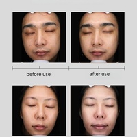 Masque de carboxythérapie au CO2 OEM Collagène Acétyl Hexapeptide-8, sérums infusés d'oxygène CO2, gel + kit de masque facial oxygénant
