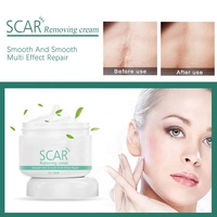 Soulagement des vergetures et brûlures visage peau pores dissolvant crème visage peau réparation cicatrice élimination crème
