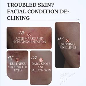 KORMESIC toptan 30ml cilt bakımı anti-kırışıklık Panthenol peptide peptide peptide mide kafein Niacinamide VC beyazlatma yüz serumu - Product Image 3