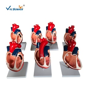 Tıbbi Bilim Ekipmanları Eğitimi Anatomik İnsan Kalp Modeli, Kalp Modeli Öğretimi için Doğumdan Beri Kalp Hastağlığı Modelleri - Product Image 2