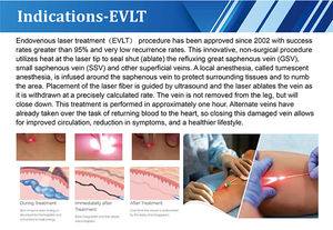 Láser de Fibra EVLT Portátil de Escritorio, Gran Venta, 1470nm 1940nm, Láser Diodo Endovenoso para Eliminación de Arañas Vasculares y Venas Varicosas - Product Image 2