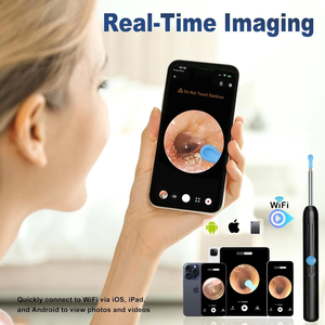 Wireless Otoscope <strong>Ear</strong> Wax Removal Earwax Removal Kit 1080P HD <strong>Ear</strong> <strong>Cleaner</strong> <strong>with</strong> <strong>Camera</strong> - Product Image 5