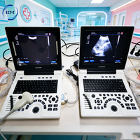 Appareil d'échographie portable numérique noir et blanc multifonctionnel pour le diagnostic en milieu hospitalier/clinique