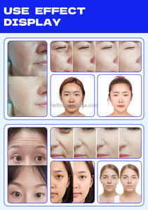 เครื่องพ่นน้ำทำความสะอาดผิวหน้าแบบ Dermabrasion สำหรับการทำความสะอาดผิวอย่างล้ำลึก ฟื้นฟูผิว และอุปกรณ์สปา ขายตรง - Product Image 4