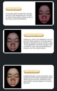 Analizador Multiespectral de Pantalla Grande para Observación de la Piel en 3D con Detección Facial de Alta Resolución - Product Image 6