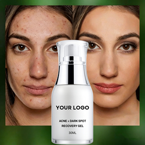 เจลกำจัด<span class=keywords><strong>สิว</strong></span> 30 มล. ไม่มีโลโก้ เจลลดสิว บำรุงผิว ควบคุมความมัน ปลอบประโลมผิว ซ่อมแซมผิวจากสิว บำรุงผิวหน้า - Product Image 1