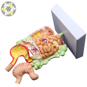 العلوم الطبية التشريحية نموذج الأمعاء المعوية المرضية والمعدة - Product Image 4