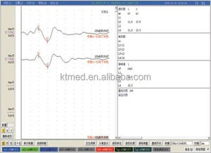 Système portable <span class=keywords><strong>EMG</strong></span> et EP KT-G057 pour le diagnostic clinique médical des potentiels évocés auditifs du nerf auditif - Product Image 6