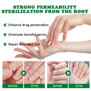 Solution de soin des ongles des orteils Essence naturelle des ongles Fix renouveler les moules endommagés ongles cassés fissurés ongles décolorés sérum de réparation rapide - Product Image 4