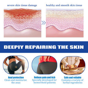 كبسولات البواسير الطبيعية بالجملة من الشركة المصنعة الأصلية، كبسولات طويلة المفعول للشق الشرجي للرعاية الصحية - Product Image 3