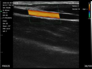 B26E Cardiac <span class=keywords><strong>Abdominal</strong></span> Vascular 3 en 1 Aplicación de clínica inalámbrica portátil Equipo de ultrasonido de diagnóstico de escaneo dual para móvil - Product Image 3