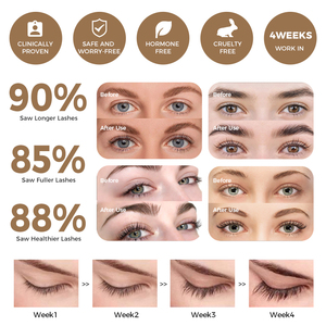 Suero para el Crecimiento de Pestañas <span class=keywords><strong>Eye</strong></span> Lash <span class=keywords><strong>Surge</strong></span>, Sin Aceite, Clínicamente Probado para Pestañas Más Gruesas - Product Image 4