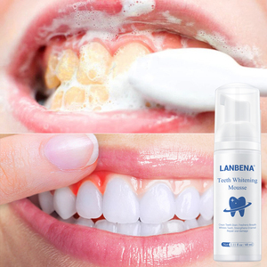 LANBENA blanqueamiento de dientes de espuma de mousse de blanqueamiento boca al por mayor - Product Image 1