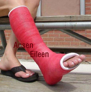 Bande de plâtre en <span class=keywords><strong>fibre</strong></span> médicale de haute qualité pour fractures, bandage en <span class=keywords><strong>fibre</strong></span> de verre orthopédique - Product Image 4