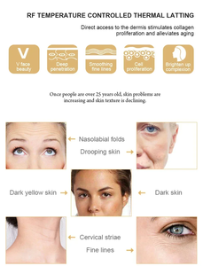 Masseur facial portable à microcourant RF <span class=keywords><strong>pour</strong></span> raffermir la peau, la resserrer et lutter contre le vieillissement, appareil de traitement facial - Product Image 3