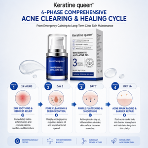 Großhandel Schnell Wirksames Reparatur-Gel gegen Pickel-Narben und Flecken, verkleinert Poren, 14% Azelainsäure, Akne-Gesichtscreme - Product Image 3