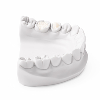 Ecolab – Restauration dentaire en céramique Emax de qualité supérieure pour laboratoires et cliniques – Modèle durable pour la réparation naturelle des dents – Conforme ISO