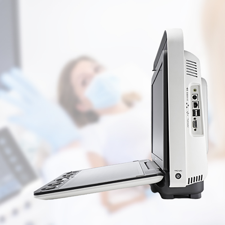 Máquina de ultrasonido de alta resolución Sonoscape S9 Sistema de ultrasonido Doppler a color con sonda