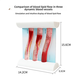 แบบจำลองหลอดเลือดแบบไดนามิก การเปรียบเทียบการอุดตันของคราบไขมันในหลอดเลือดแดงสำหรับการ<span class=keywords><strong>สอน</strong></span>ทางการแพทย์ - Product Image 4