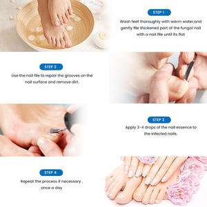 Líquido Reparador Herbal <span class=keywords><strong>de</strong></span> Acción Profunda, Alivio Duradero, Cuidado Hidratante, Tratamiento para Mejorar la Salud, <span class=keywords><strong>Hongos</strong></span> en <span class=keywords><strong>las</strong></span> <span class=keywords><strong>Uñas</strong></span> Rotas - Product Image 4