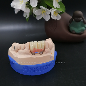 Prothèses dentaires sécurisées sur implant Ponts en zircone Arc complet Chine Laboratoire <span class=keywords><strong>dentaire</strong></span> <span class=keywords><strong>Prix</strong></span> compétitif - Product Image 1