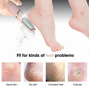 Điện Callus Remover chân tập tin scraper chân mờ móng chân công cụ loại bỏ chân rasp loại bỏ da chết công cụ chăm sóc bàn chân - Product Image 4