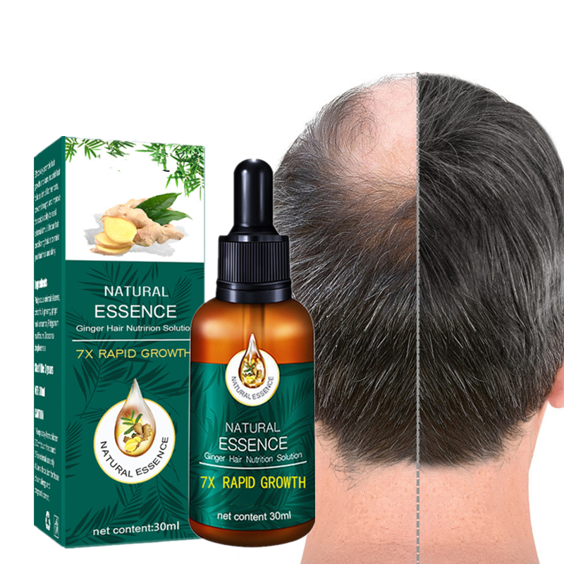 Solución Nutririon para el crecimiento del cabello para hombre y mujer, productos de tratamiento para el cuidado de la pérdida de cabello, suero de jengibre vegano, aceite orgánico de etiqueta privada