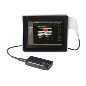 MT mesin <span class=keywords><strong>Ultrasound</strong></span> Kedokteran Hewan portabel, diagnostik <span class=keywords><strong>Digital</strong></span> <span class=keywords><strong>Ultrasound</strong></span> - Product Image 3