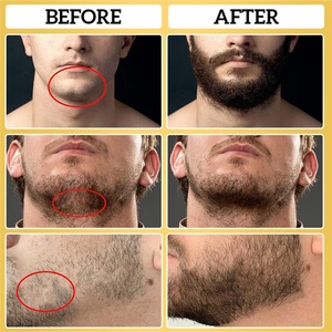 Set de Cuidado Masculino al por Mayor de Fábrica, Bálsamo 100% Natural para el Crecimiento de la Barba, Humectante con Aceites de Jojoba y Argán - Product Image 6