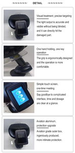 Fuente de Luz Excimer de 308nm Libre de Impuestos para Cloración Médica, Belleza y Cuidado Personal, Vitiligo, Psoriasis, Ultravioleta - Product Image 6