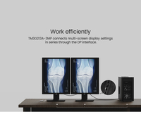 21,3 Zoll 3MP Medizinischer LCD-Monitor IPS-Panel LED-Bildschirm DP-Anschluss für Desktop-Medizingeräte