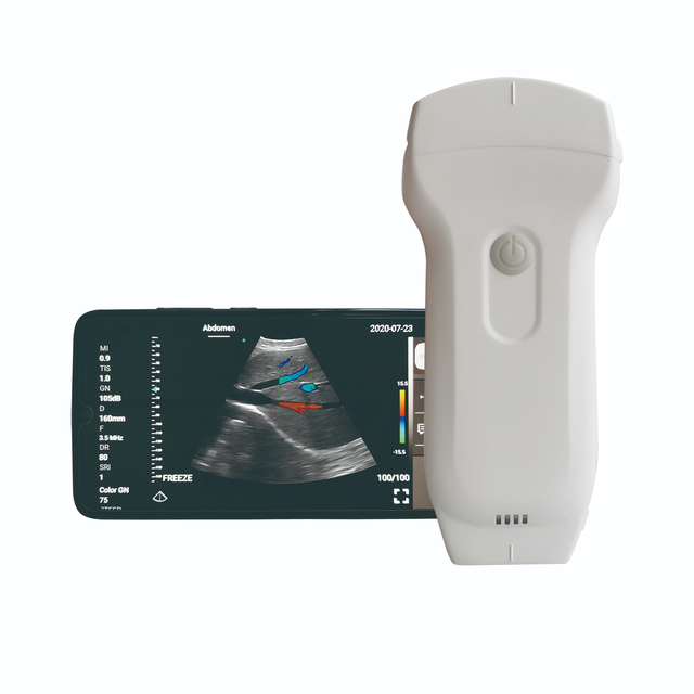 High Quality Cheap Handheld Pet/Human Use Mini Portable Double Head Wireless Ultrasound Scanner Veterinary Diagnostic Device