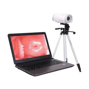 Colposcope numérique pour gynécologie, caméra électronique de colposcopie vidéo pour <span class=keywords><strong>vagin</strong></span> - Product Image 4