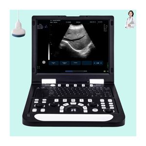 Mesin pemindai <span class=keywords><strong>Ultrasound</strong></span> portabel, pemindai <span class=keywords><strong>Ultrasound</strong></span> portabel <span class=keywords><strong>4D</strong></span> Sonoscape kinerja tinggi penuh baru portabel untuk diagnostik - Product Image 1