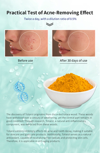 New Zealand nhập khẩu nguyên liệu Totara cây podocarpus chiết xuất chống mụn trứng cá bột mụn loại bỏ chăm sóc da mỹ phẩm lớp - Product Image 3