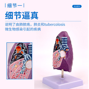 Modelo de pulmón humano, modelo de anatomía patológica del pulmón, sistema respiratorio, modelo de órgano humano, modelo de pulmón enfermo - Product Image 3