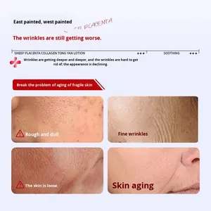 Rotiss Sheep Placentaコラーゲン有機若々しいスキンリキッドアンチリンクルファーミングフェイスセラムアンチエイジングはしわを細かくします - Product Image 3