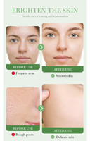 OEM Coréen Vente en gros Centella Edition Ensemble de soins de la peau Apaiser le calme Hydrater les peaux mixtes grasses sensibles