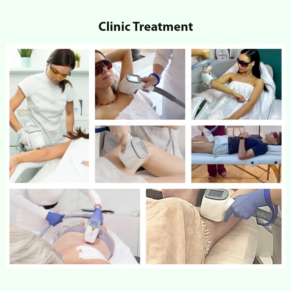 Professional diode laser hair removal system near me machine