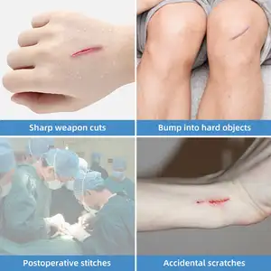 Ovand056 3pcs/box Steri-Strip Wound Closure Waterproof Emergency Wound Closure Strips Medical Wound Closure Device