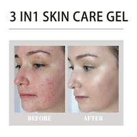 Gel efficace d'élimination de l'acné du visage dissolvant de taches d'acné à base de plantes crème de contrôle de l'huile soins de la peau Gel hydratant blanchissant pour le visage
