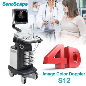 Sonoscape ultrasonido portatil ge wireless 4d ultrasound machine Ecografo color con carro