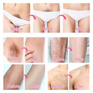 Crème Dépilatoire <span class=keywords><strong>ALIVER</strong></span> sous Marque Blanche pour Peau Douce, Corps Entier et Visage, Crème Épilatoire Naturelle Permanente pour Hommes et Femmes - Product Image 4